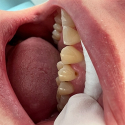 Hands-on plastkursus for tandplejere &amp; tandklinikassistenter 